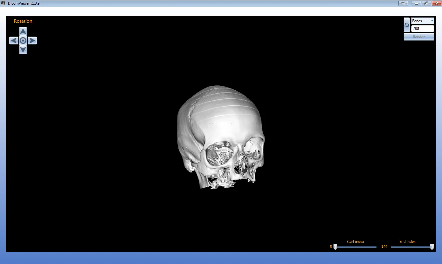 DICOM Viewer: 3D reconstruction of a skull
