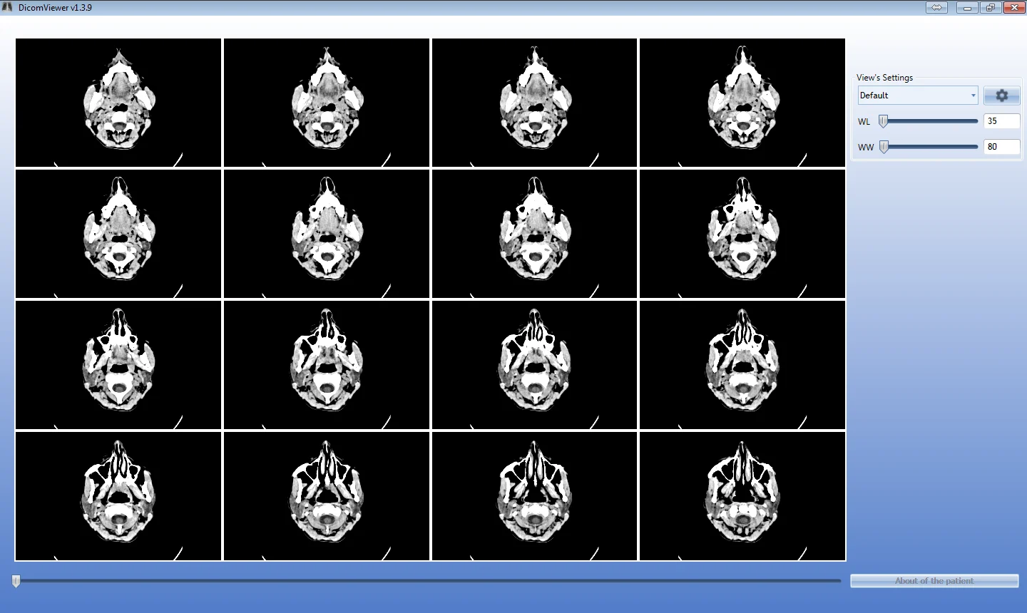DICOM Viewer: a CT series in a 4 × 4 grid